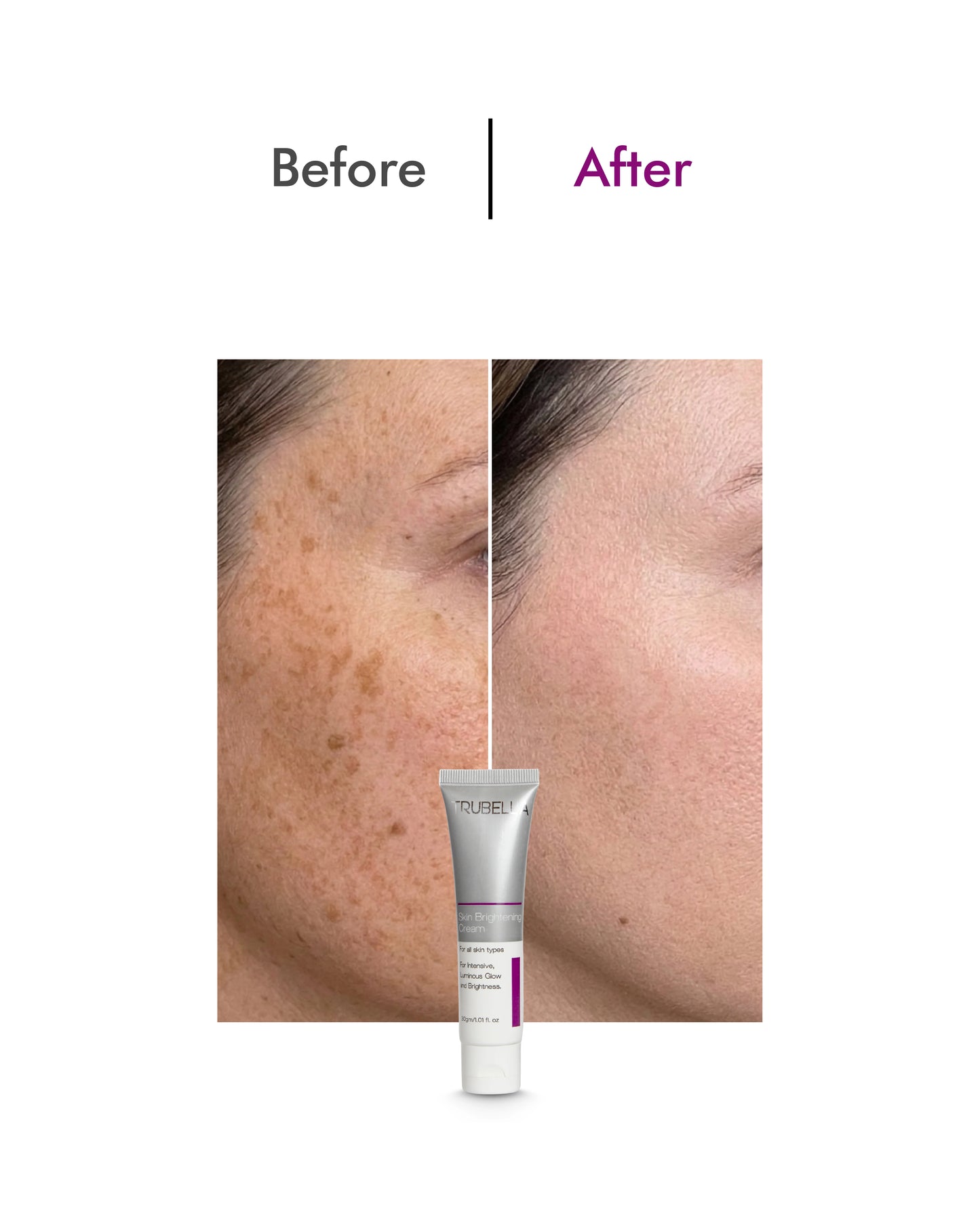Trubella Skin Brightening Cream