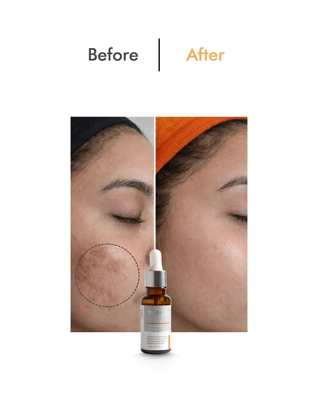 Trubella Vitamin C Serum