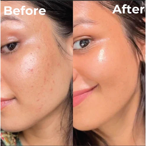 Brightening Serum before after results