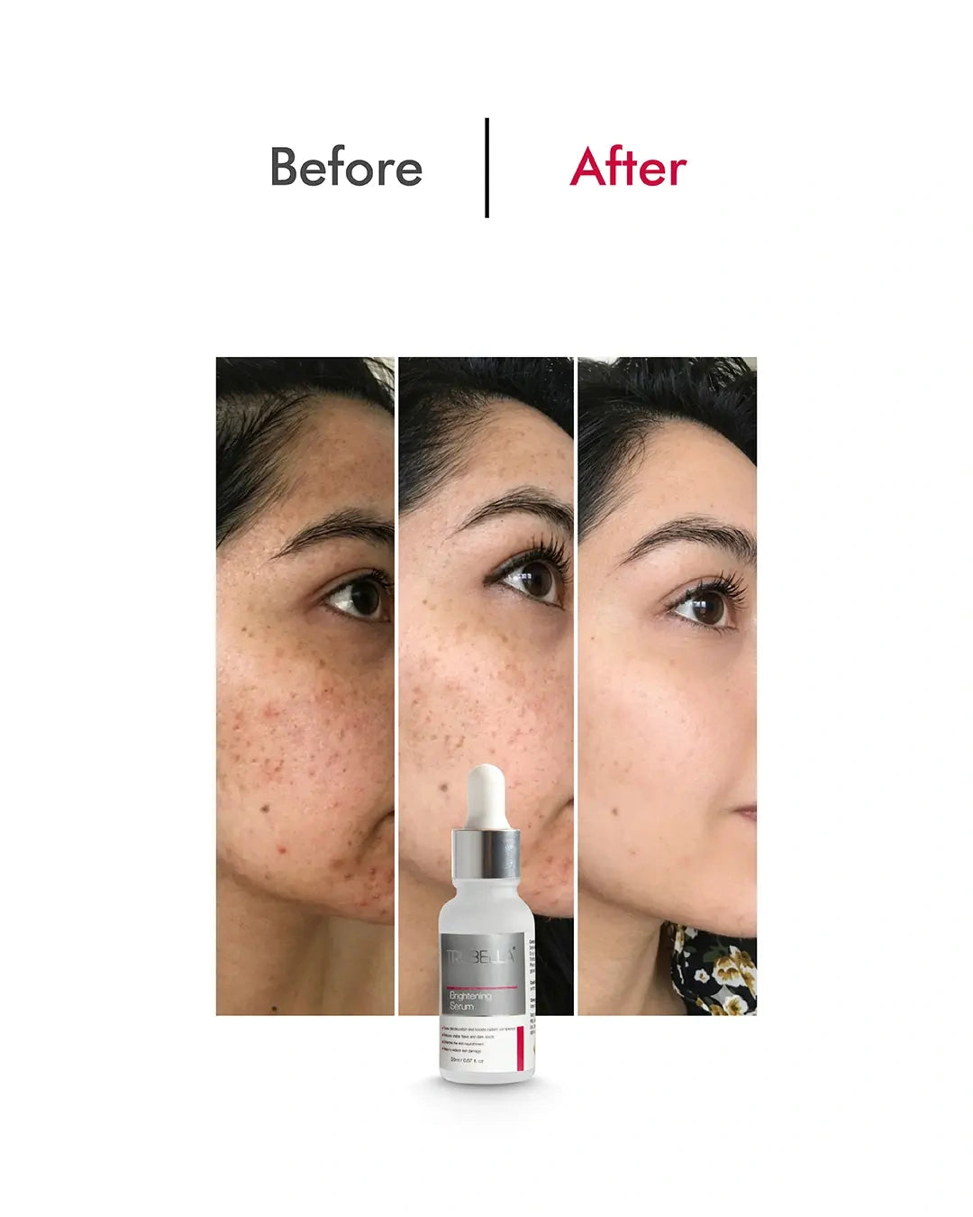 Trubella Brightening Serum