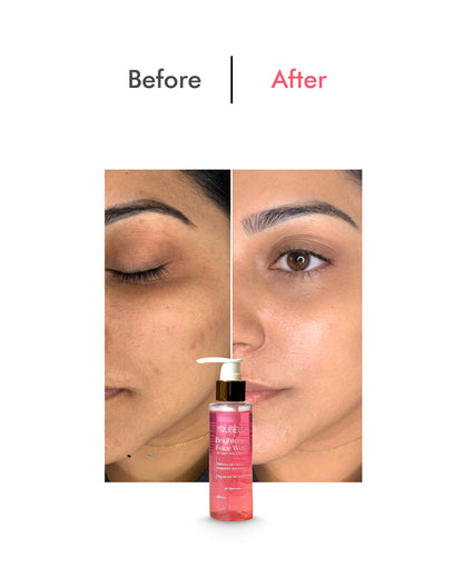 Trubella Brightening Face Wash