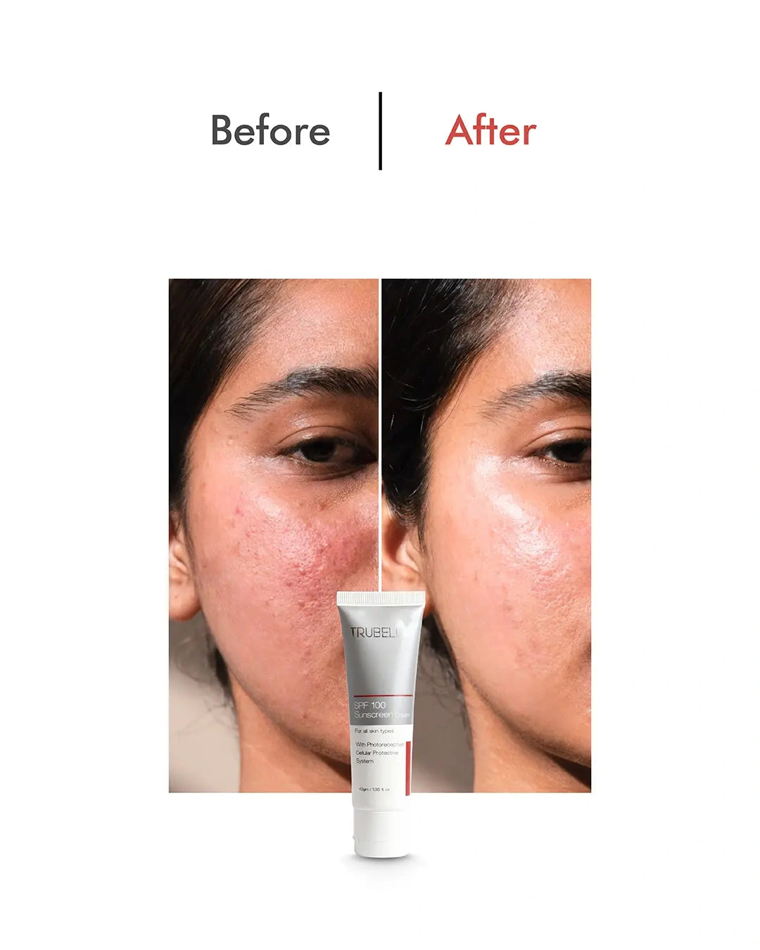 Trubella Sunscreen Cream SPF 100