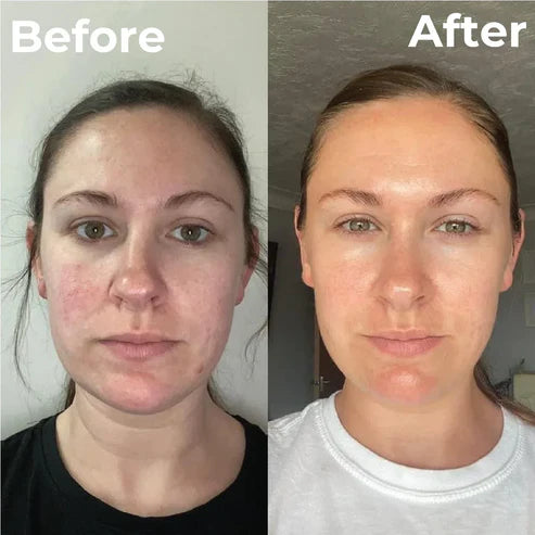 Trubella Brightening Face Wash before after results