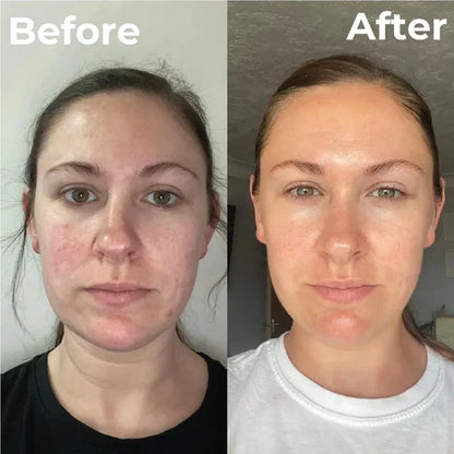 Trubella Brightening Face Wash before after results
