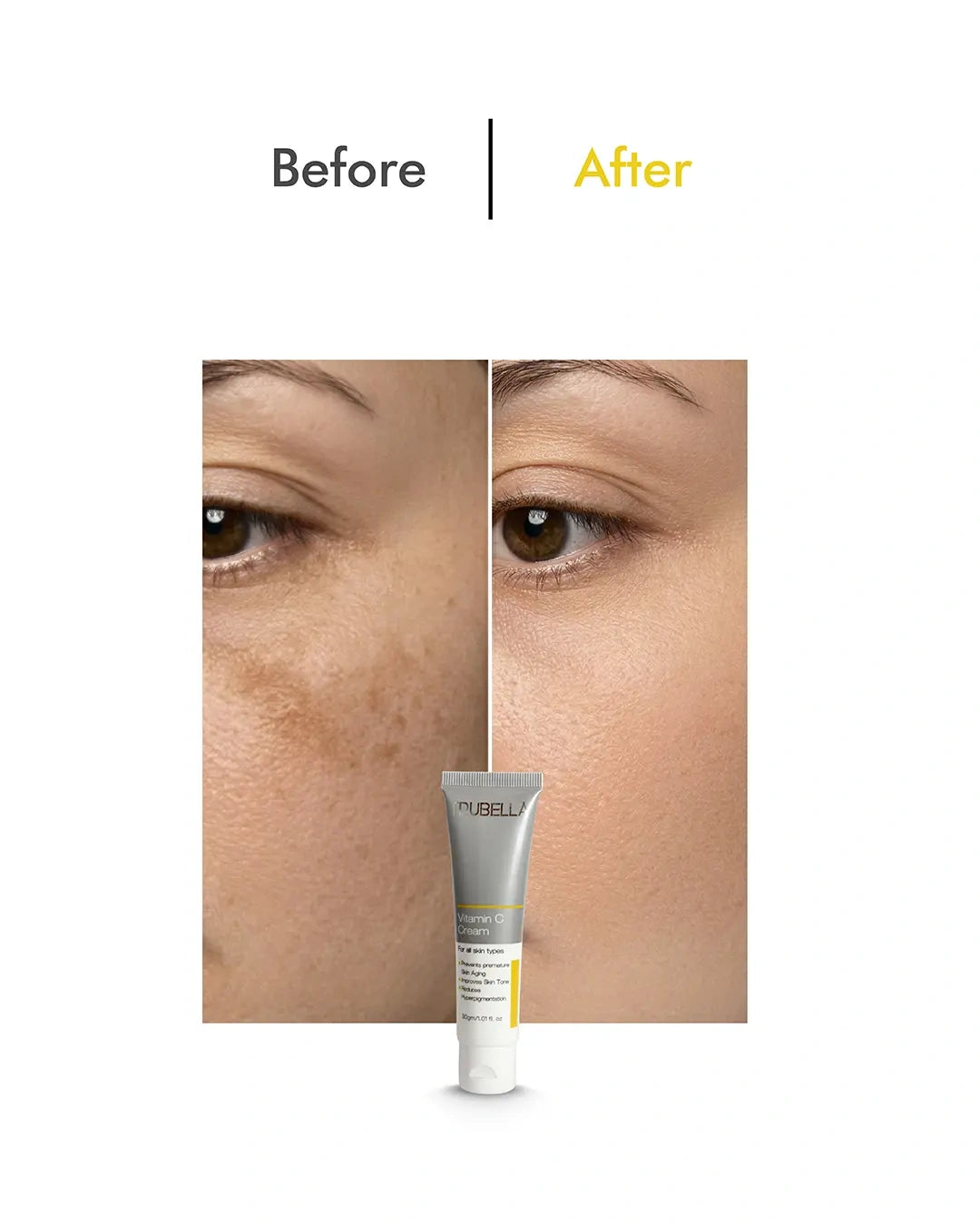 Trubella vitamin c before after results