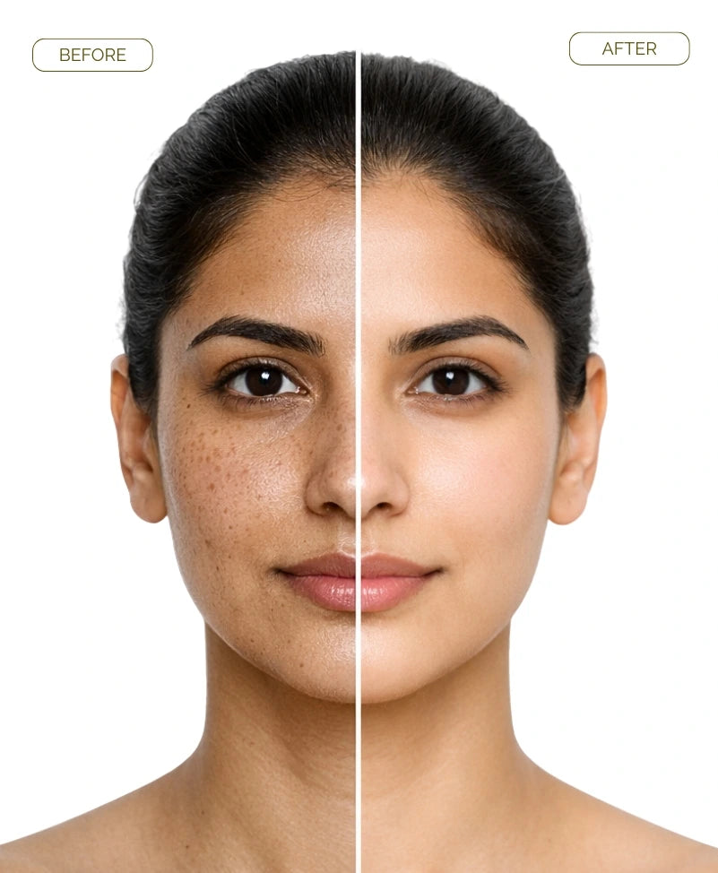 glutawhite cream before and after female results