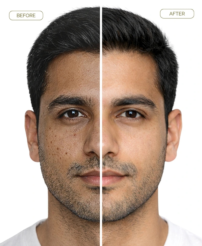 Gluta White Cream – Skin Brightening Cream in Pakistan